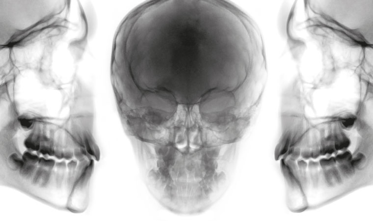 Maestría en Radiología Oral y Maxilofacial